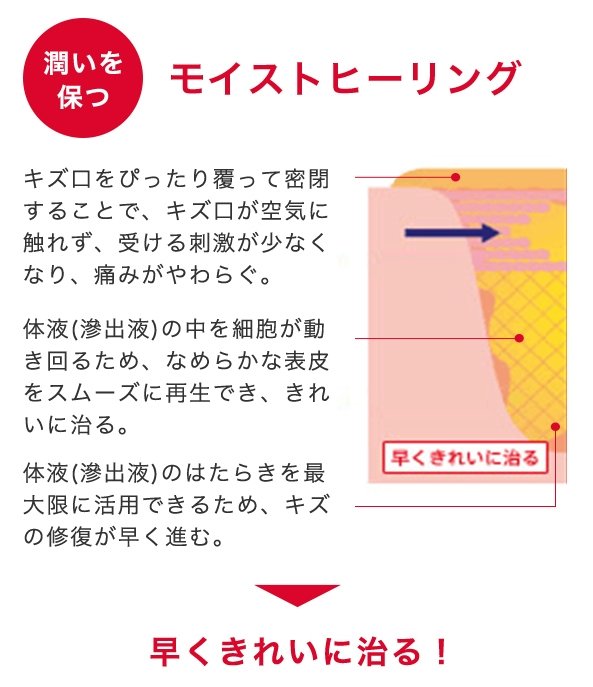 ジョンソン・エンド・ジョンソン バンドエイド キズパワーパッド 大きめサイズ 12枚【管理医療機器】Johnson & Johnson Band Aid Hydrocolloid Gel Wound Power Pad, All-purpose Large size 10 count, Size: (L) 70 x (W)44 mm