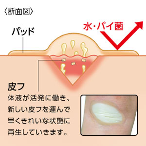 ジョンソン・エンド・ジョンソン バンドエイド キズパワーパッド 水仕事用 10枚【管理医療機器】Johnson & Johnson Band-Aid Hydrocolloid Gel Wound Power Pad, for Kitchen Work 10 count, Size: (L) 60 x (W)20 mm