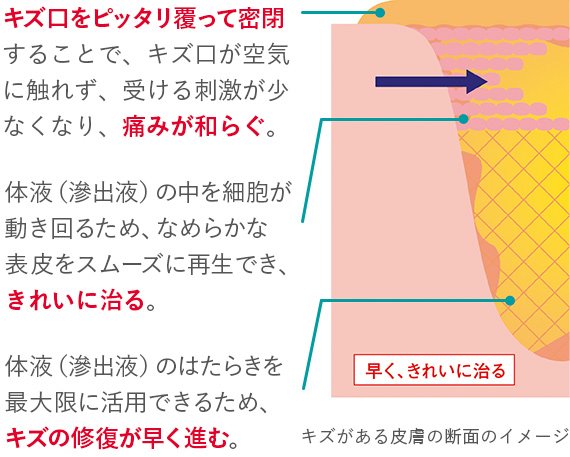 ジョンソン・エンド・ジョンソン バンドエイド キズパワーパッドプラス ふつうサイズ　10枚【管理医療機器】Johnson & Johnson Band-Aid Hydrocolloid Gel Wound Power Pad Plus, All-purpose normal size 10 count, Size: (L) 60 x (W)20 mm