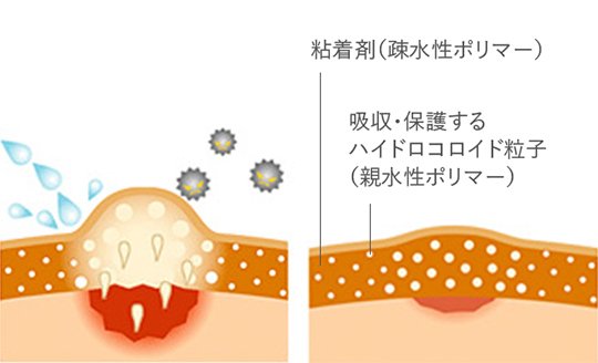 ジョンソン・エンド・ジョンソン バンドエイド キズパワーパッドプラス ジャンボサイズ 3枚【管理医療機器】Johnson & Johnson Band-Aid Hydrocolloid Gel Wound Power Pad Plus, Jumbo size 3 count Size: (L) 70 x (W)62 mm